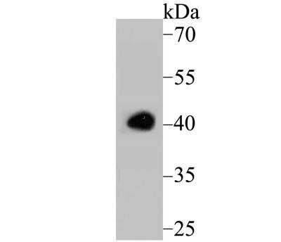 Western Blot: ATG3/APG3 Antibody [NBP3-09060]