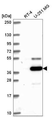 Western Blot: ATG4A Antibody [NBP2-56465]