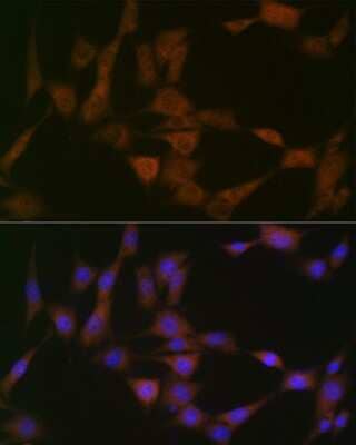 Immunocytochemistry/ Immunofluorescence: ATG4B Antibody (9H6M6) [NBP3-16538]