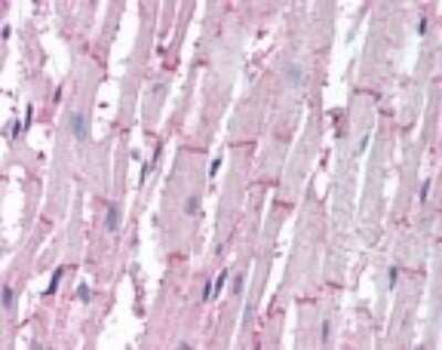 Immunohistochemistry-Paraffin: ATG4B Antibody [NBP2-24709]