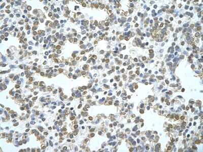 Immunohistochemistry-Paraffin: ATG4B Antibody [NBP3-10327]