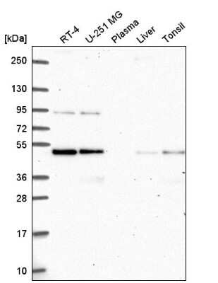 Western Blot: ATG4B Antibody [NBP2-57210]