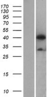 Western Blot: ATG4B Overexpression Lysate [NBL1-07797]