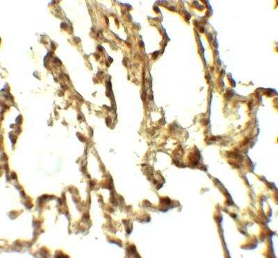 Immunohistochemistry: ATG4C Antibody - BSA Free [NBP2-81954]