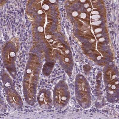 Immunohistochemistry: ATG4D Antibody [NBP2-49525]