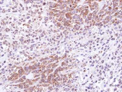 Immunohistochemistry-Paraffin: ATG4D Antibody [NBP1-33488]