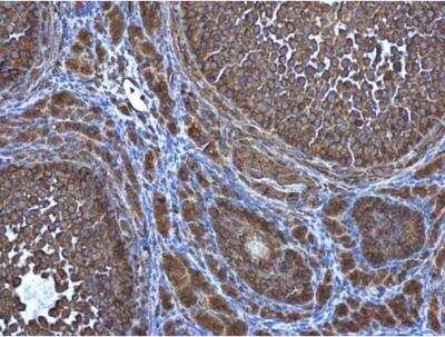 Immunohistochemistry-Paraffin: ATG4D Antibody [NBP1-33488]