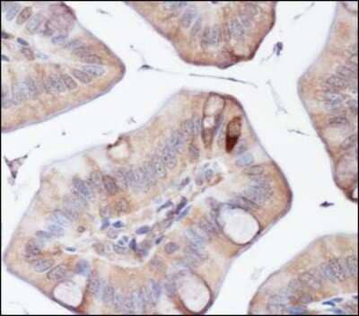 Immunohistochemistry: ATG5 Antibody - BSA Free [NB110-53818]