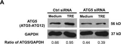 Knockdown Validated: ATG5 Antibody - BSA Free [NB110-53818]