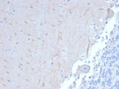 Immunohistochemistry-Paraffin: ATG5 Antibody (ATG5/2101) - Azide and BSA Free [NBP3-08504]