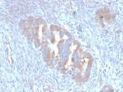 Immunohistochemistry-Paraffin: ATG5 Antibody (ATG5/2101) - Azide and BSA Free [NBP3-08504]