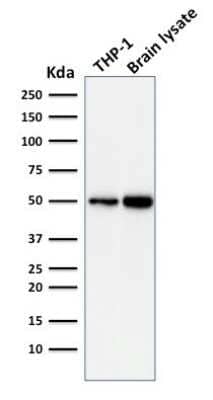 Western Blot: ATG5 Antibody (ATG5/2101) [NBP3-07889]