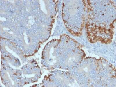 Immunohistochemistry-Paraffin: ATG5 Antibody (ATG5/2492) - Azide and BSA Free [NBP3-08433]