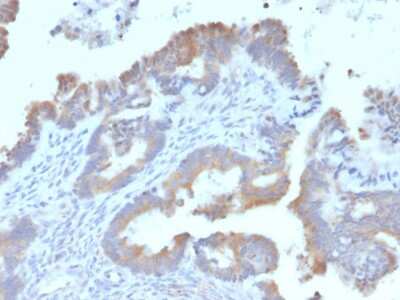 Immunohistochemistry-Paraffin: ATG5 Antibody (ATG5/2492) - Azide and BSA Free [NBP3-08433]