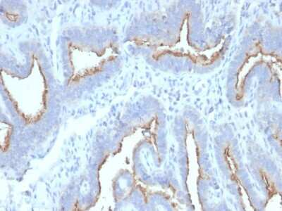 Immunohistochemistry-Paraffin: ATG5 Antibody (ATG5/2492) - Azide and BSA Free [NBP3-08433]