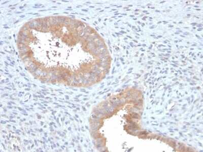 Immunohistochemistry-Paraffin: ATG5 Antibody (ATG5/2553) - Azide and BSA Free [NBP3-08434]