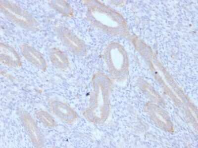 Immunohistochemistry-Paraffin: ATG5 Antibody (ATG5/2553) - Azide and BSA Free [NBP3-08434]