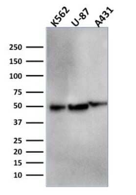 Western Blot: ATG5 Antibody (ATG5/2553) [NBP3-07880]