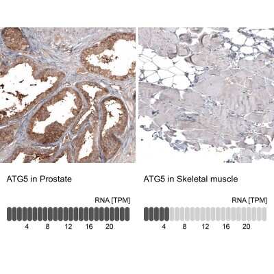 Immunohistochemistry-Paraffin: ATG5 Antibody (CL9508) [NBP2-88936]