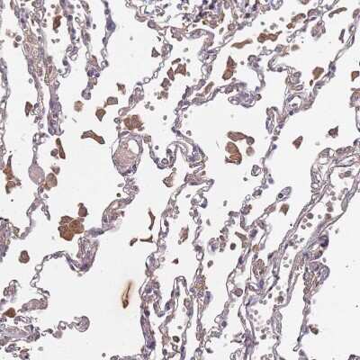 Immunohistochemistry-Paraffin: ATG5 Antibody [NBP2-54702]