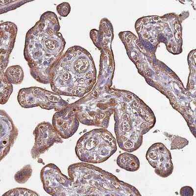 Immunohistochemistry-Paraffin: ATG5 Antibody [NBP2-54702]