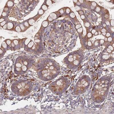 Immunohistochemistry-Paraffin: ATG5 Antibody [NBP2-54702]