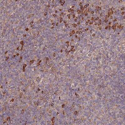 Immunohistochemistry-Paraffin: ATG5 Antibody [NBP2-54702]