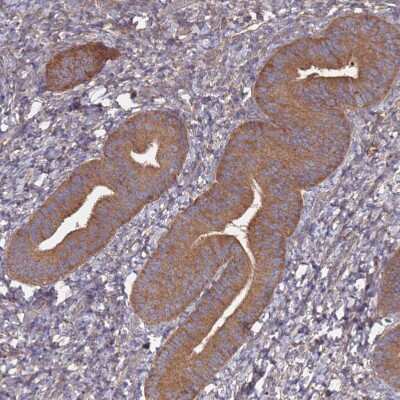 Immunohistochemistry-Paraffin: ATG5 Antibody [NBP2-54702]