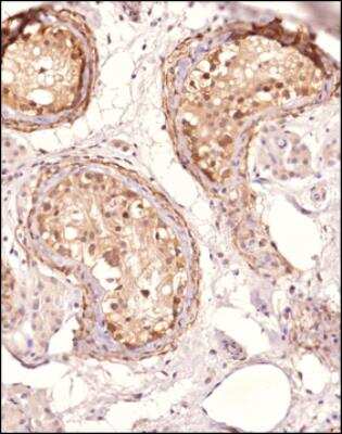Immunohistochemistry-Paraffin: ATG5 Antibody - BSA Free [NBP3-11775]