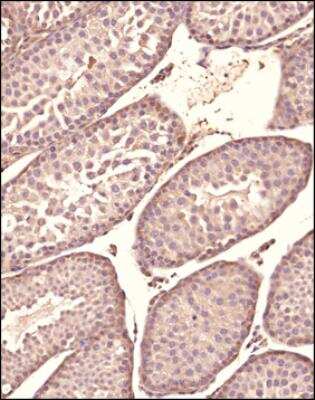 Immunohistochemistry-Paraffin: ATG5 Antibody - BSA Free [NBP3-11775]