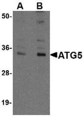 Western Blot: ATG5 AntibodyBSA Free [NBP1-76992]