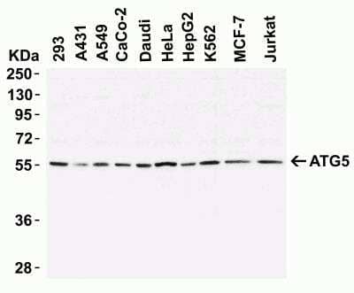 Western Blot: ATG5 AntibodyBSA Free [NBP1-76992]