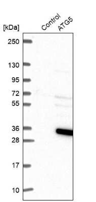 Western Blot: ATG5 Antibody [NBP2-54702]