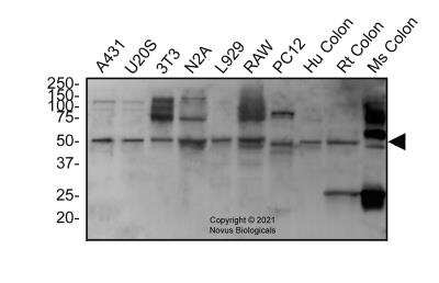 Western Blot: ATG5 AntibodyBSA Free [NBP3-11775]