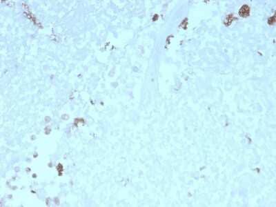 Immunohistochemistry-Paraffin: ATG5 Antibody (rATG5/2553) [NBP3-07881]