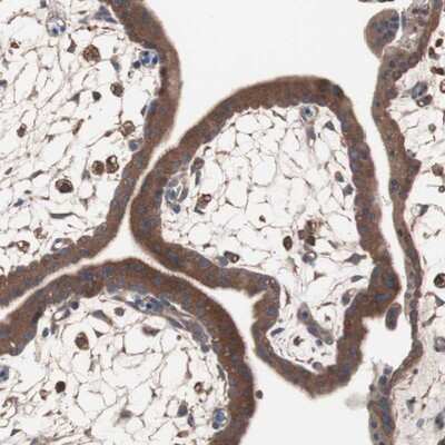Immunohistochemistry-Paraffin: ATG7 Antibody [NBP1-89042]