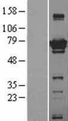 Western Blot: ATG7 Overexpression Lysate [NBL1-07800]