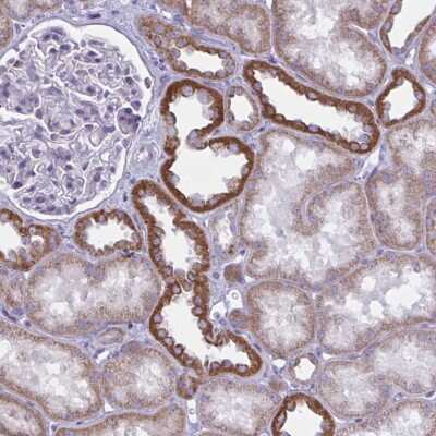 Immunohistochemistry-Paraffin: ATG9A Antibody [NBP2-32477]