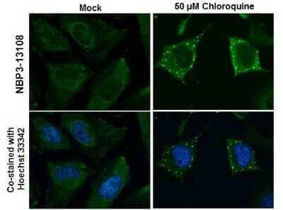 Immunocytochemistry/ Immunofluorescence: ATG9B Antibody [NBP3-13108]