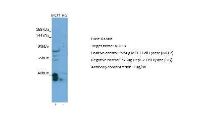 Western Blot: ATG9B Antibody [NBP2-88772]