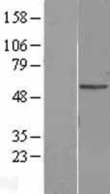 Western Blot: PEDFR/PNPLA2/ATGL Overexpression Lysate [NBL1-14554]