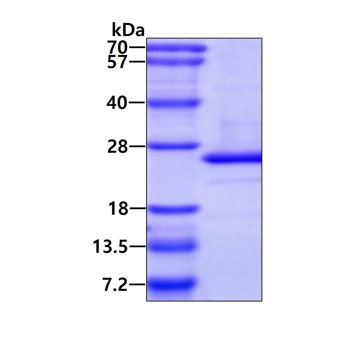 SDS-PAGE: Recombinant Human ARL5A His Protein [NBP1-50900]