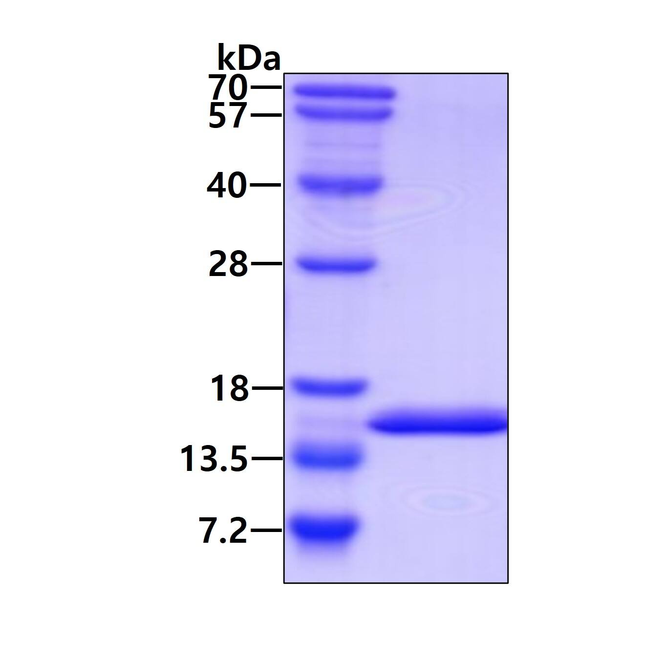 SDS-PAGE: Recombinant Human ROBLD3 His Protein [NBP1-50918]