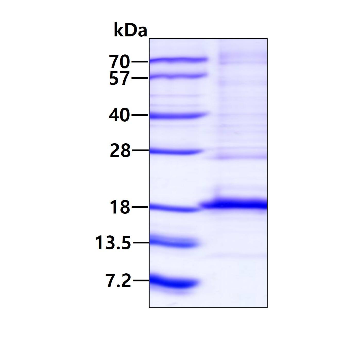 SDS-PAGE: Recombinant Human DUSP19 His Protein [NBP1-78816]