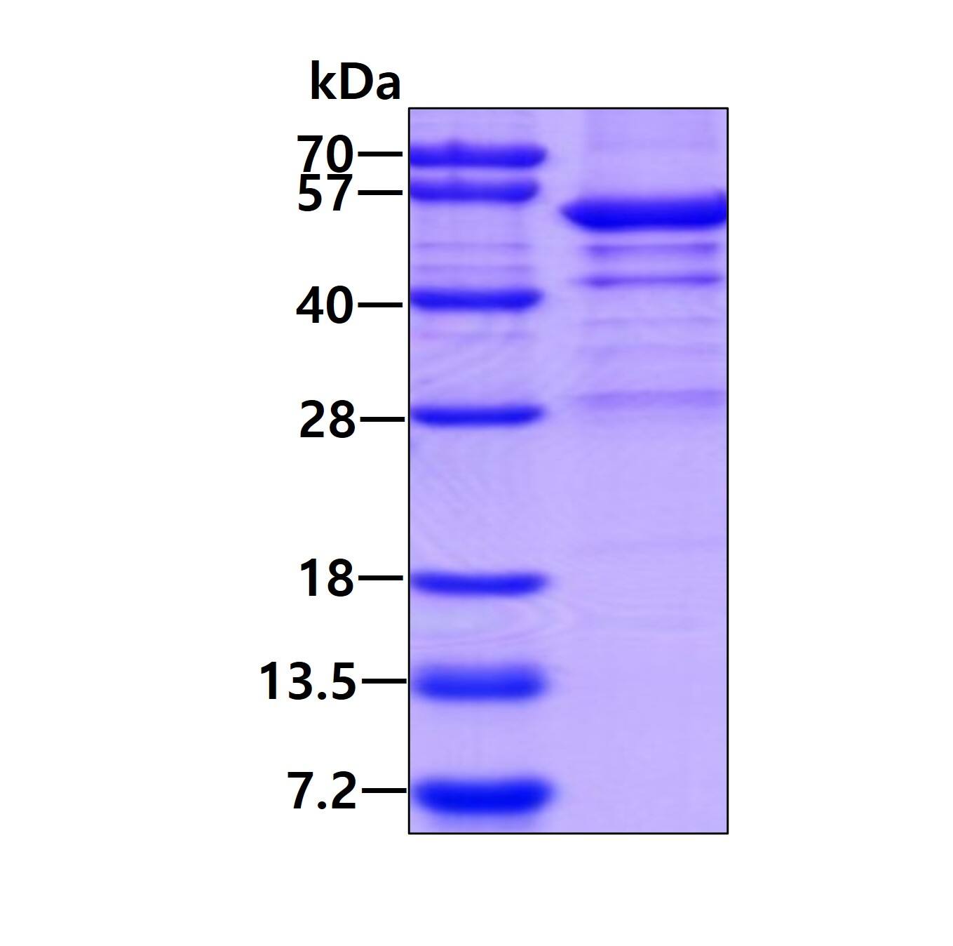 SDS-PAGE: Recombinant Human UMPS His Protein [NBP2-22934]