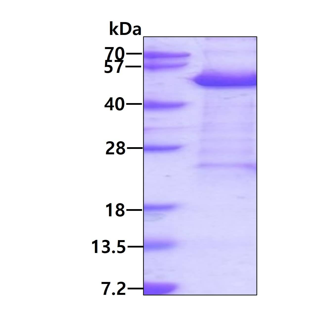 SDS-PAGE: Recombinant Human KIN His Protein [NBP2-23174]