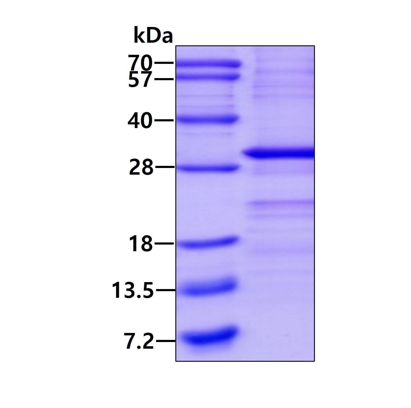 SDS-PAGE: Recombinant Human SSX1 His Protein [NBP2-22841]