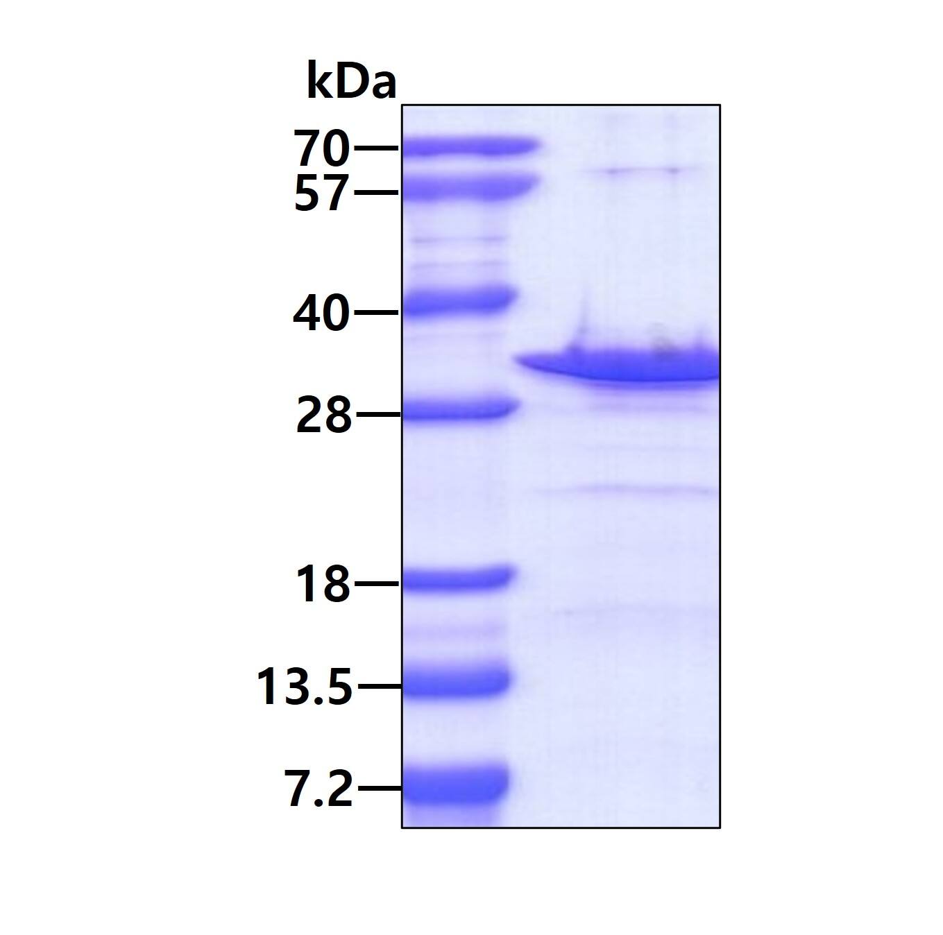 SDS-PAGE: Recombinant Human Sperm-associated antigen 7 His Protein [NBP2-22817]