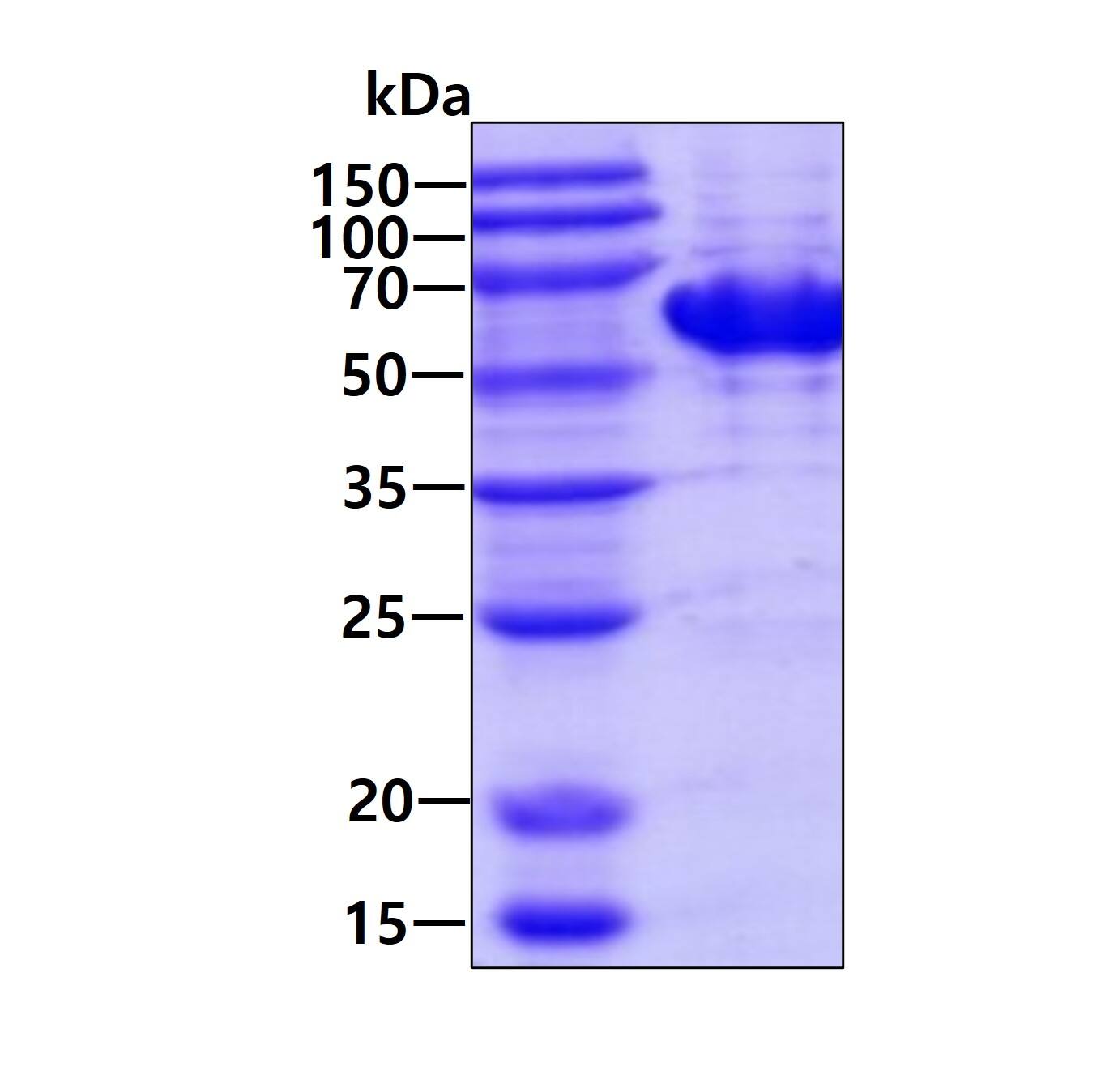 Recombinant Human TBC1D22B His Protein