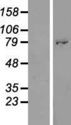 Western Blot: ATHL1 Overexpression Lysate [NBP2-06241]